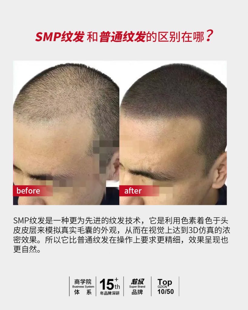 SMP纹发和普通纹发的区别